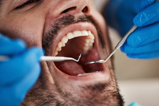 Best Emergency Treatment for Oral Infections in Horseheads North, NY